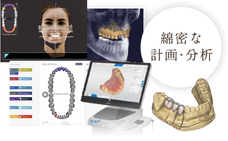 綿密な計画・分析