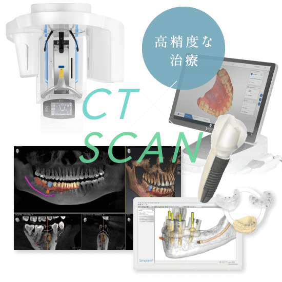 高精度な治療 CT・SCAN