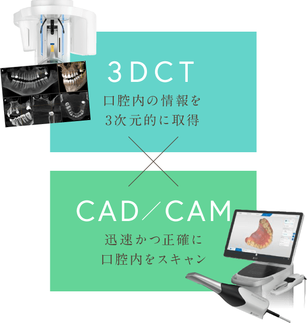 3DCT：口腔内の情報を3次元的に取得 CAD／CAM：迅速かつ正確に口腔内をスキャン