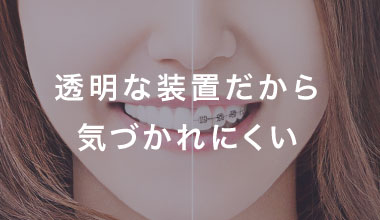 透明な装置だから気づかれにくい