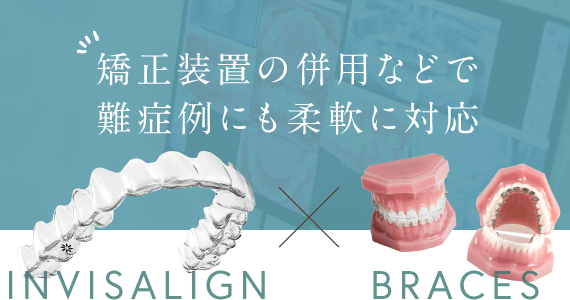 矯正装置の併用などで難症例にも柔軟に対応