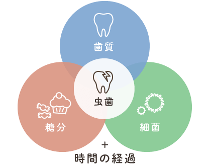 虫歯の原因：「歯質」「糖分」「細菌」＋時間の経過